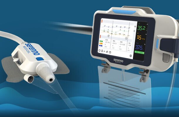 startup israeli inventa monitor de orina