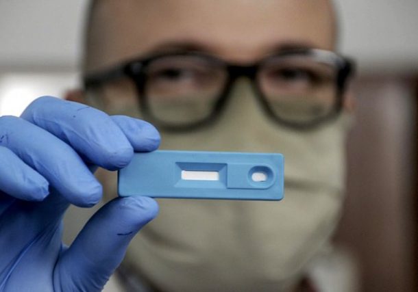 aprueban test covid en Argentina
