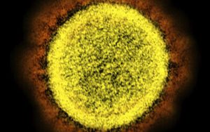 Esta imagen de microscopio electrónico de 2020 muestra una partícula de SARS-CoV-2 aislada de un paciente, en un laboratorio en Fort Detrick, Maryland. Los coronavirus, incluido el más nuevo, reciben su nombre de los picos que cubren su superficie exterior como una corona o corona en latín (NIAID / NIH a través de AP)