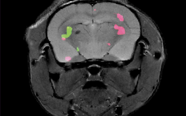 Una imagen del laboratorio del Dr. Amnon Bar-Shir que muestra dos proteínas diferentes expresadas en el cerebro de un ratón se revela mediante resonancia magnética de dos colores. Su técnica especial de teñido de genes permite utilizar resonancias magnéticas para rastrear múltiples genes en las profundidades del cuerpo. (imagen cortesía del Instituto de Ciencias Weizmann)