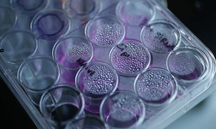 Una bandeja que contiene células cancerosas se encuentra en un microscopio óptico en el Laboratorio de Nanomedicina de la Facultad de Farmacia de la UCL en Londres el 2 de mayo de 2013. (Crédito de la foto: REUTERS/SUZANNE PLUNKETT)