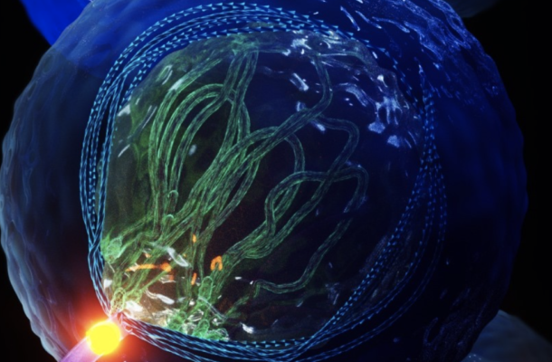 Con el hallazgo de un cromosoma, los israelíes abren un posible nuevo camino para combatir la infertilidad