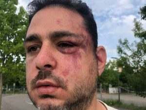 Radio Jai - Liron Rozenhaft, marido de una candidata investida por Les Républicains para las elecciones legislativas de Estrasburgo fue atacado violentamente