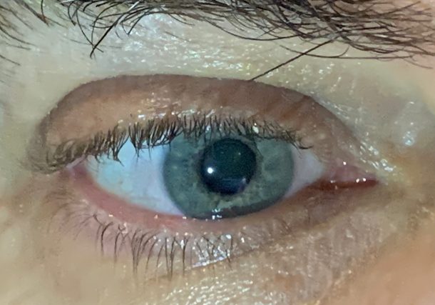 Radio Jai -Estudio israelí revela las causas de la degeneración macular asociada a la edad