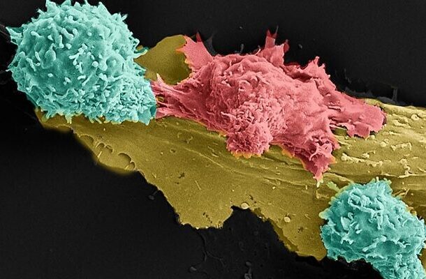 Radio Jai -Una imagen del laboratorio de la Universidad de Bar Ilan del profesor Cyrille Cohen, que muestra dos células inmunitarias en verde luchando contra una célula cancerosa en rojo, en la nueva inmunoterapia inventada allí (Cyrille Cohen, Tilda Barliya y Astar Shamul)