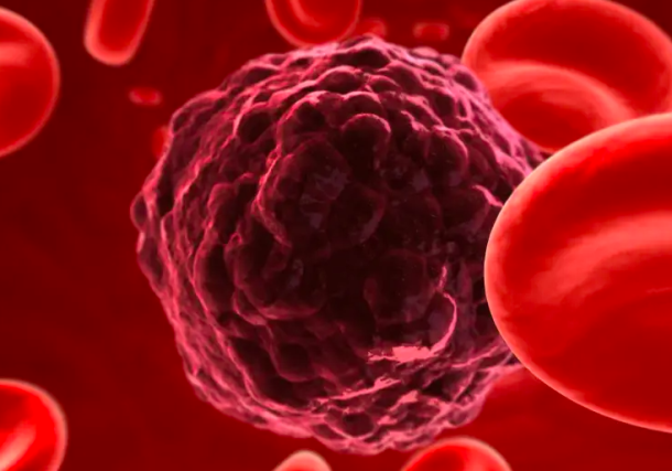 Radio Jai -Científicos del TAU descubren nuevo tratamiento para el cáncer de ovario