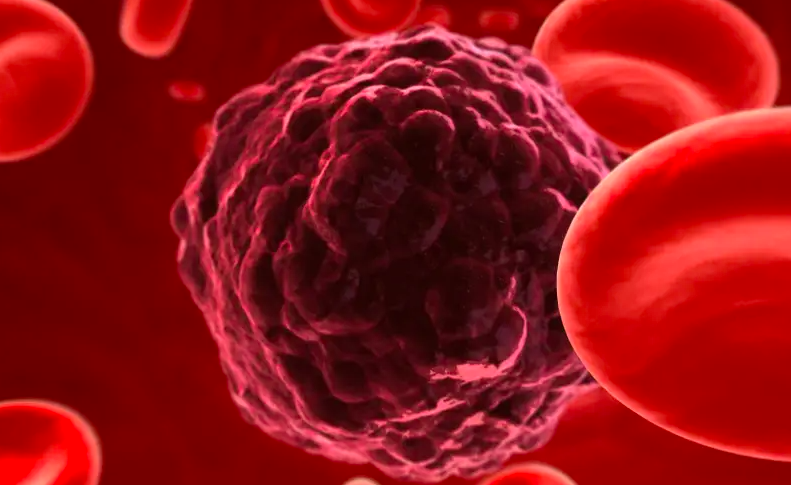 Radio Jai -Científicos del TAU descubren nuevo tratamiento para el cáncer de ovario