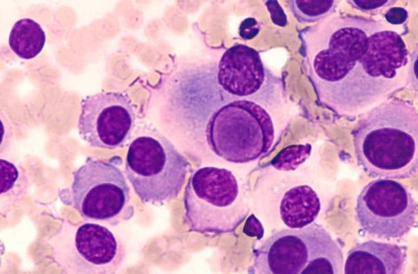 Gran avance en la lucha contra el cáncer de piel-Radio Jai