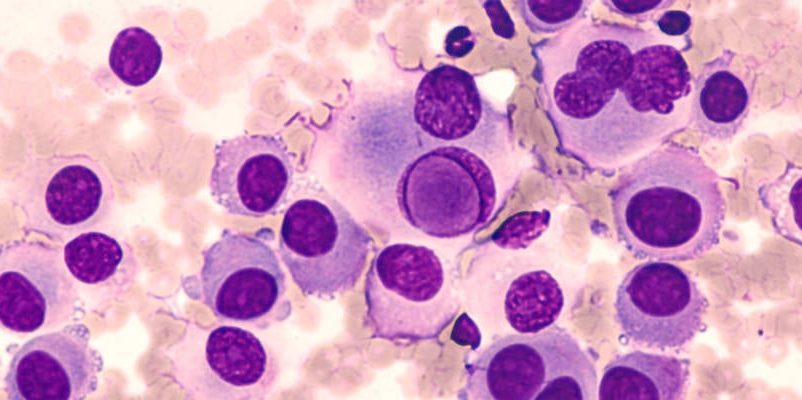 Gran avance en la lucha contra el cáncer de piel-Radio Jai