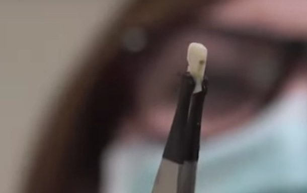 Radio Jai -Una molécula natural que previene la placa y las caries