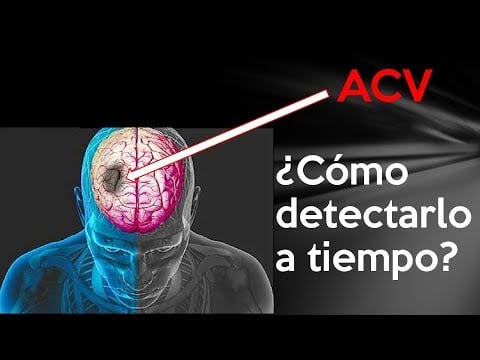 Radio Jai-ACV: Cómo detectarlo a tiempo puede salvar la vida