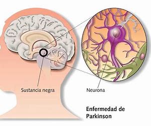Radio Jai-Tics, TOCs y Parkinson: Lo que todos debemos saber sobre el sistema nervioso